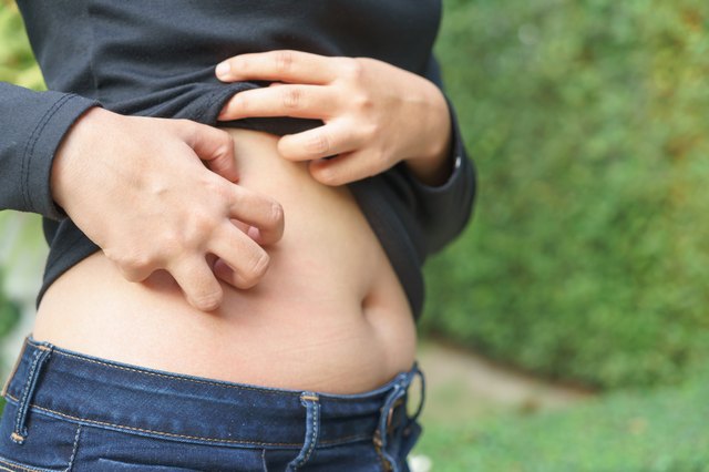 7 Reasons Your Bellybutton Is So Itchy Livestrong