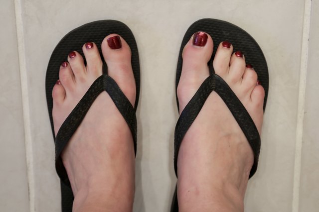 How To Get Rid Of Smelly Feet From Sandals Livestrong