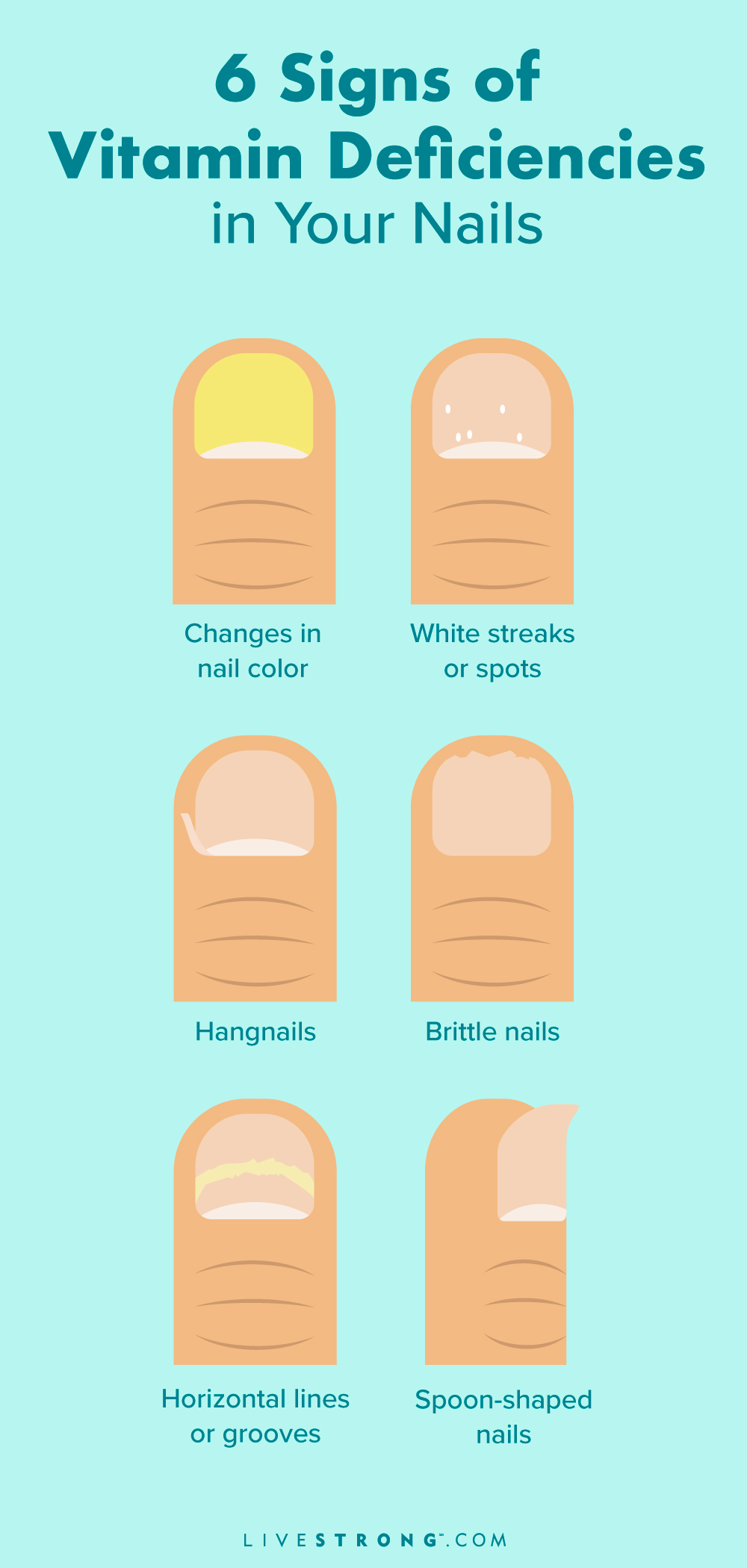 Here's what your nails can reveal about your health :::MissKyra