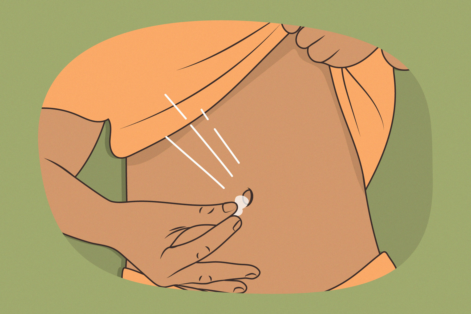 What Should You Do If Your Belly Button Piercing Is Infected 2024 epicamlv