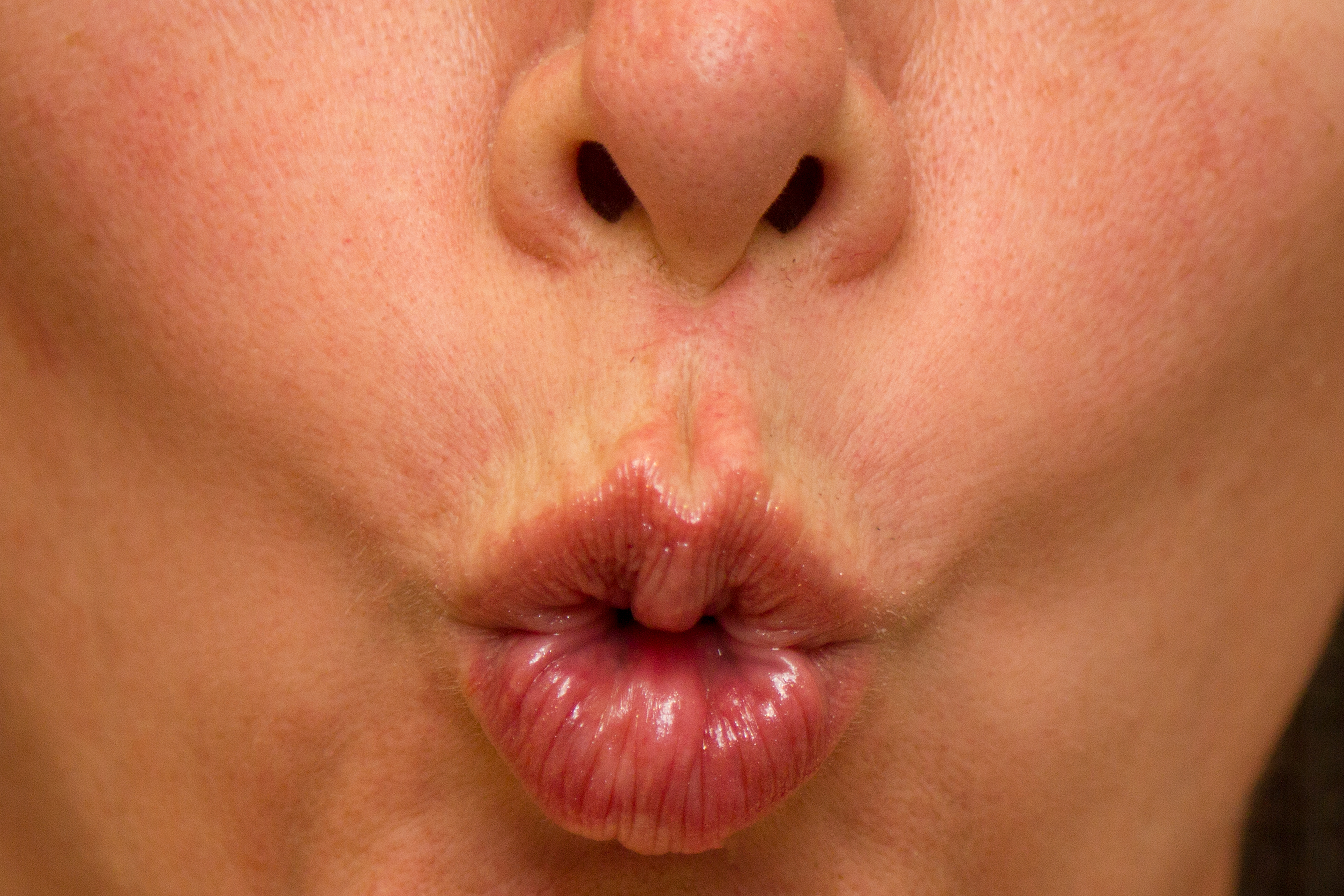 Facial Exercises for the Lips livestrong