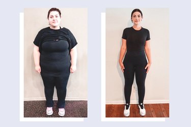 Gastric Sleeve Before and After Photos