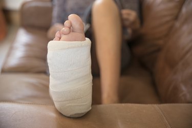 Close Up Of Mature Woman With Leg In Plaster Cast Lying On Sofa At Home