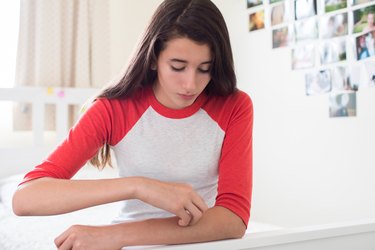 Teenage Girl Sitting In Bedroom Scratching Arm