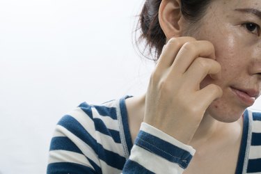 asian young woman scratching face on isolated white background