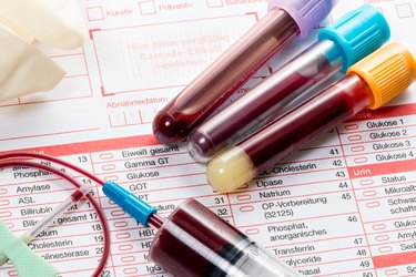 Blood test, blood samples on a laboratory form