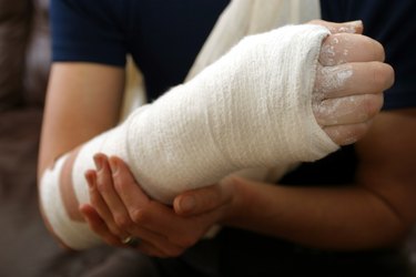 Broken arm in a white cast wrap