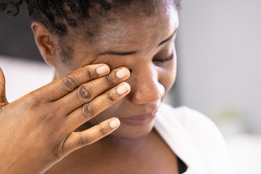 a woman rubbing her eye because she has watery burning eyes