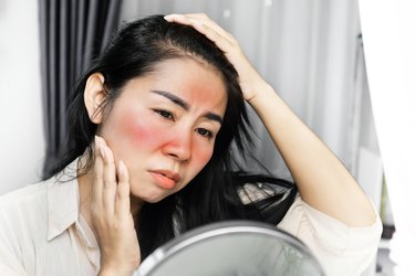 a person with long black hair and a butterfly rash or lupus rash on their face looking in the mirror
