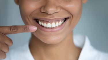 close view of a person with brownish-pink healthy gums smiling and pointing to their gums