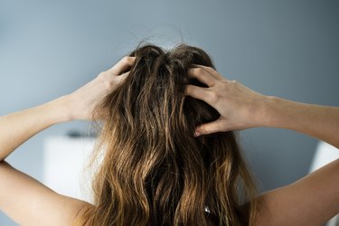 10 Causes of an Itchy Scalp and How to Treat It | livestrong
