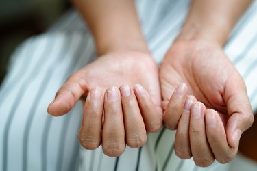 close view of a person's fingernails