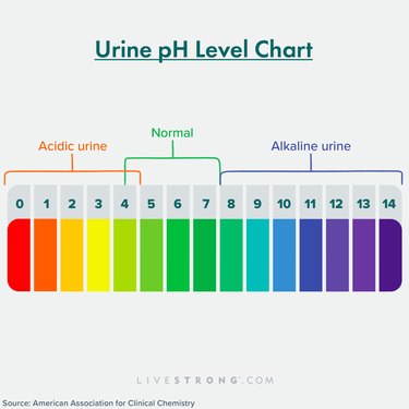 A colorful urine pH level chart showing acidic, normal and alkaline urine levels on a scale of 0 to 14