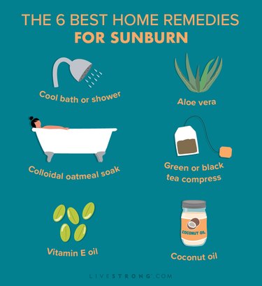 illustrations of the best home remedies for sunburn on a dark teal background