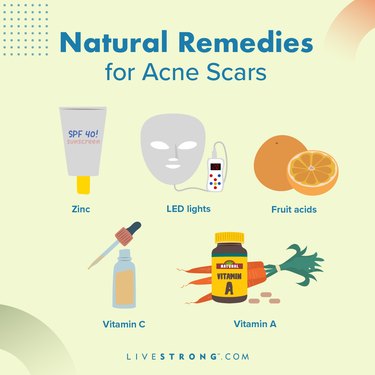 an illustration of natural remedies for acne scars, including zinc, LED lights, fruit acids, vitamin c and vitamin a