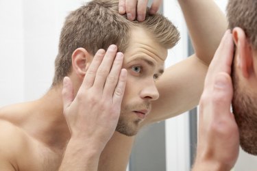 Handsome young man worried about hairloss