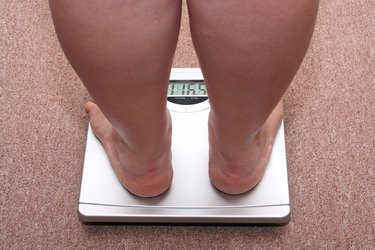 women legs with overweight