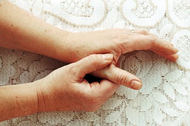 A woman's hands with painful arthritis