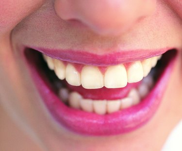 Close-up of Woman's Teeth