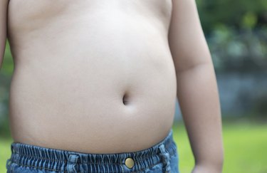 children with overweight.
