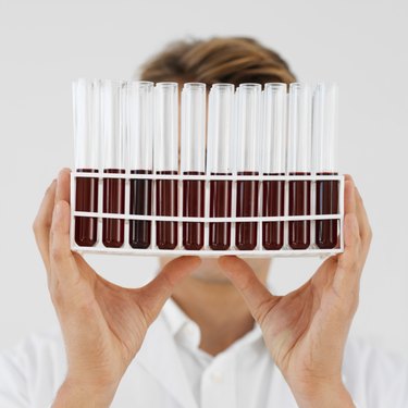 Close-up of a doctor holding test tube rack of blood samples