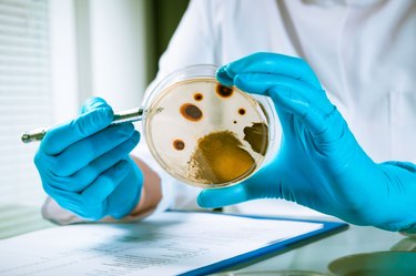 Agar plate with growing germs