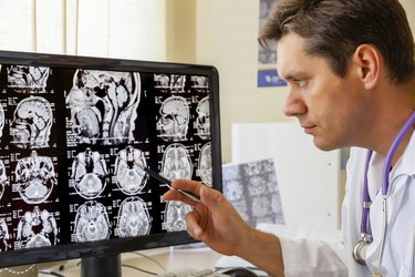 Doctor examining an MRI scan of the Brain