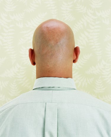 Bald man, close-up, rear view