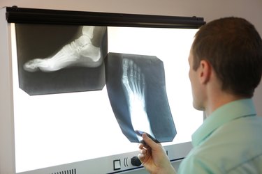 specialist watching images of foot at x-ray film viewer