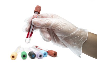 Blood tests and test tubes