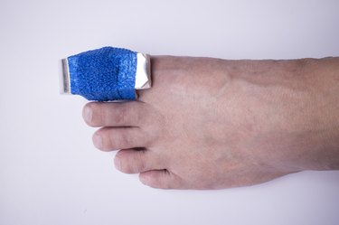 Phalanx fracture with splint and elastic gauze