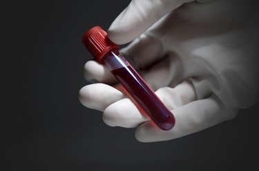 Blood sample