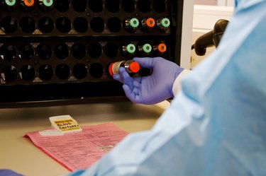 Blood culture incubation vials