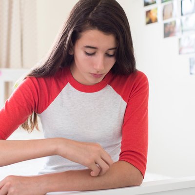 Teenage Girl Sitting In Bedroom Scratching Arm