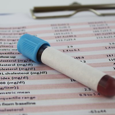 cholesterol test