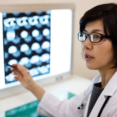 Close-up of female radiologist pointing at medical x-ray in hospital