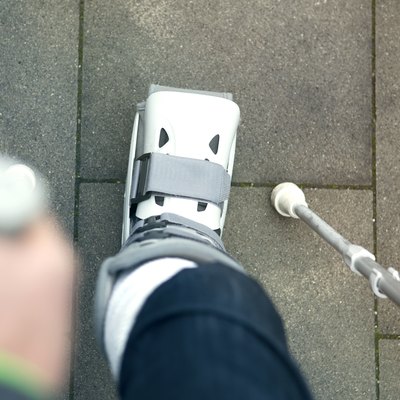 closeup of person walking with cast on foot