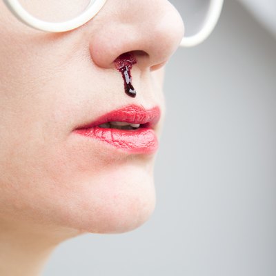 closeup of woman with nosebleed