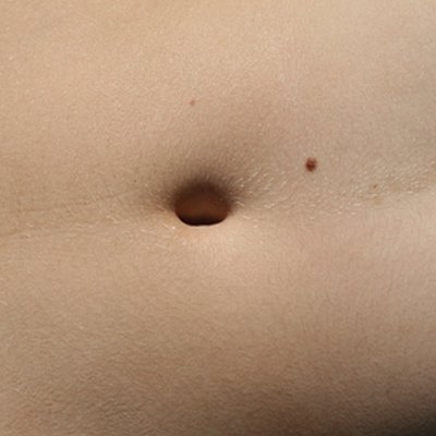 Abdominal pain, many causes
