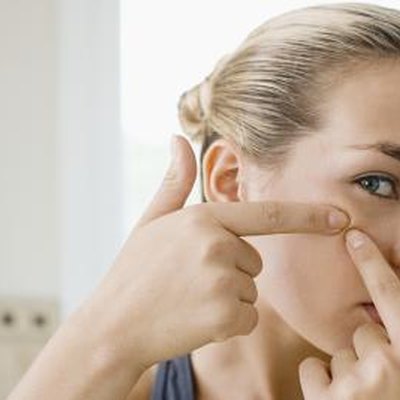 A sign, chronic potassium deficiency, acne, dry skin