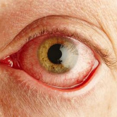 Pigmentation, the iris, your eye color