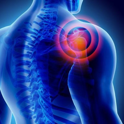 3D Illustration of shoulder painful, medical concept.