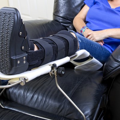 Lady with Fractured Leg
