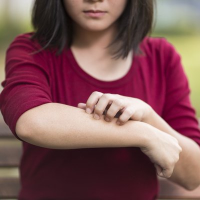 Woman Scratching Her Arm Sitting on Bench at Park