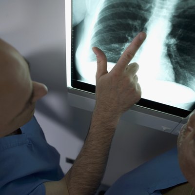 High angle view of two doctors looking at x-ray