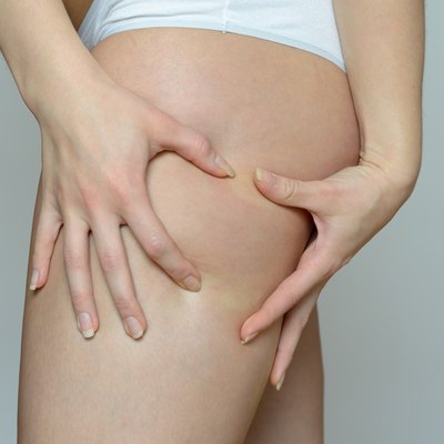 Woman Pinches her Thigh Using Two Hands