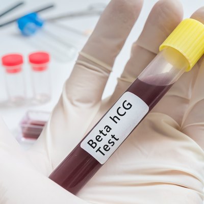 Test tube with blood for Beta hCG Test in hand.