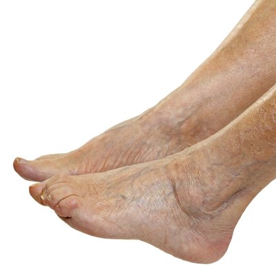 Elderly feet