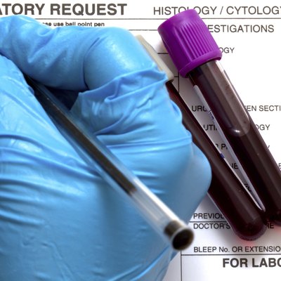 Laboratory Request