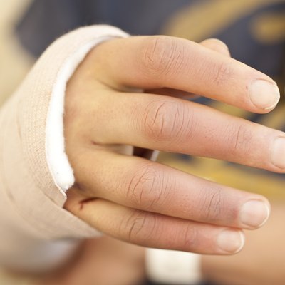Patient's Hand